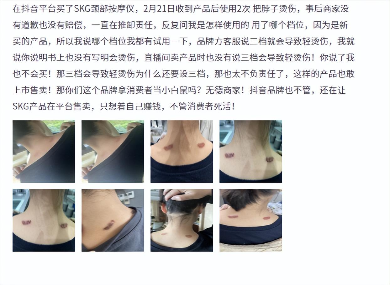 SKG是什么品牌？分享skg品牌介紹及產品質量優勢分析